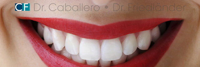 como blanquear los dientes