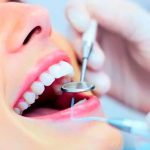 ¿Qué es una limpieza dental? ¿Cada cuanto debe hacerse?