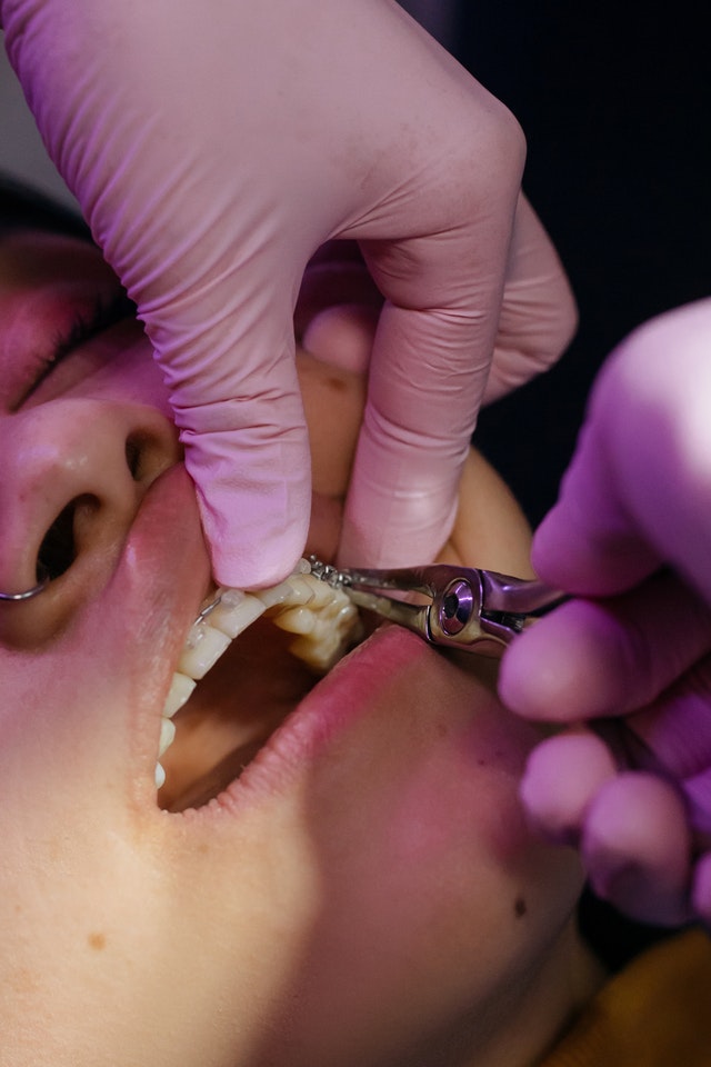 brackets de zafiro